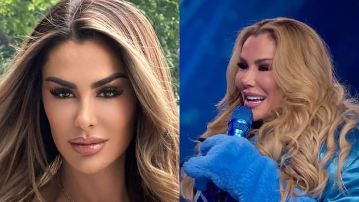 Ninel Conde, la adicción a las cirugías le destrozó el rostro; recibe ...