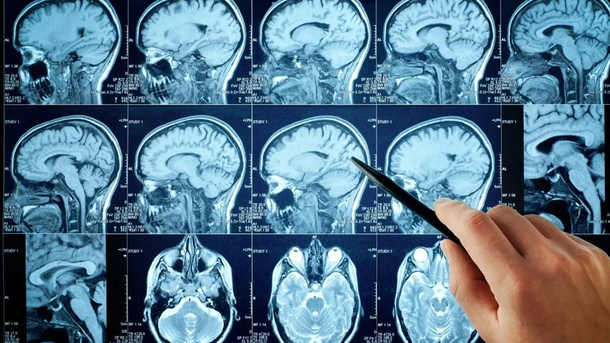 El cerebro tiene un botón de "borrar". Un nuevo estudio revela cómo eliminar memorias negativas