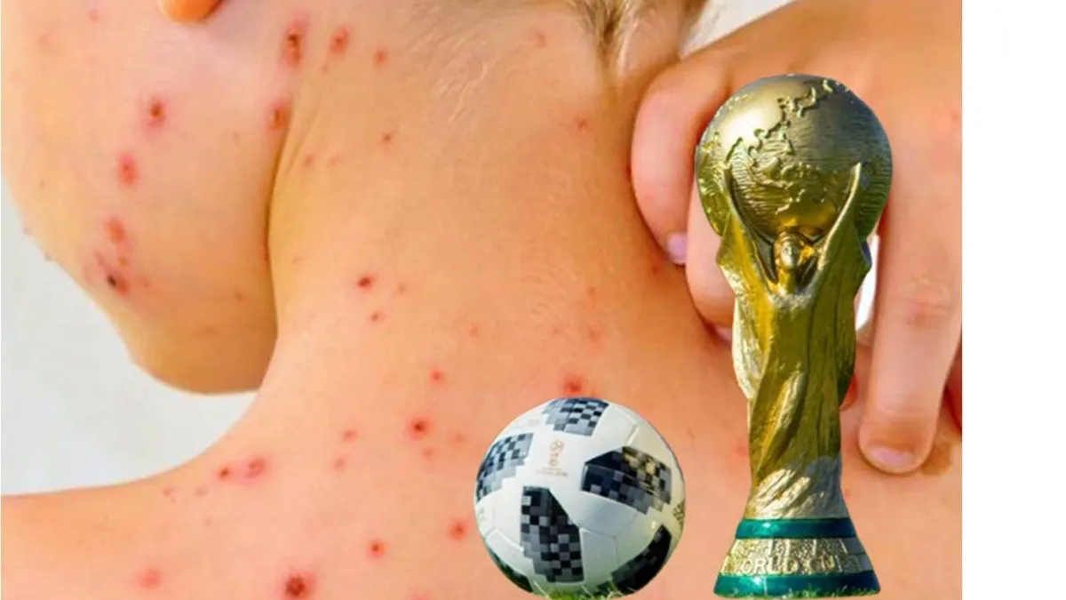 ¿México en riesgo? La carrera contra el tiempo para no perder el título de "País Libre de Sarampión"